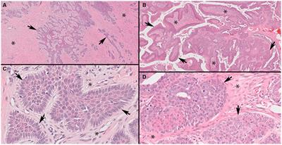 Confirmation of canine acanthomatous ameloblastoma using RAS Q61R immunohistochemical staining of formalin-fixed paraffin-embedded tissues